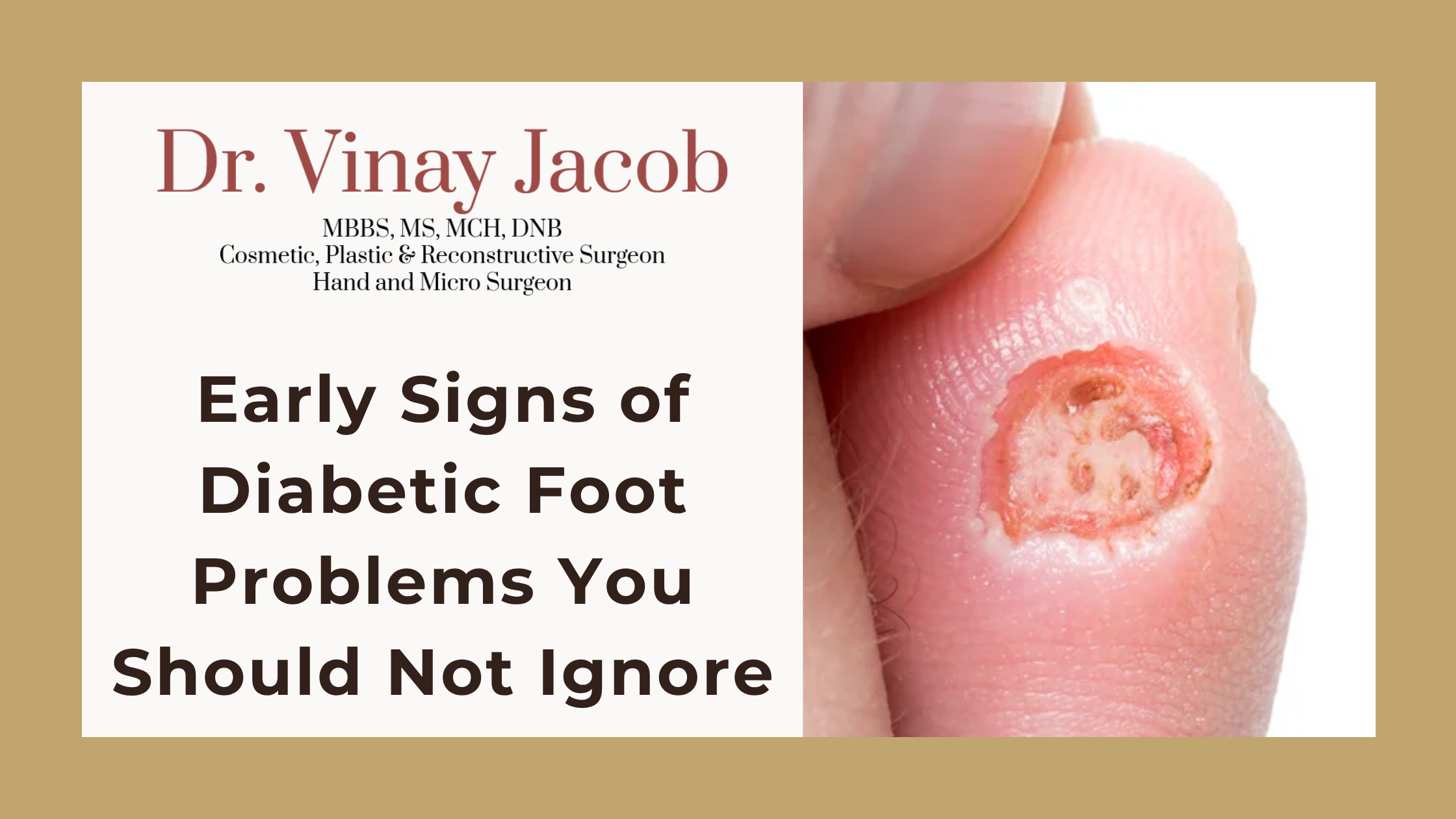 Early Signs of Diabetic Foot Problems You Should Not Ignore